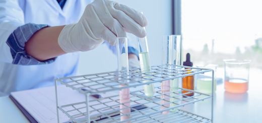 Dłoń w chirurgicznej rękawiczce lateksowej trzyma probówkę z kolorowym płynem. Stojak z innymi probówkami i szkłem laboratoryjnym w tle.